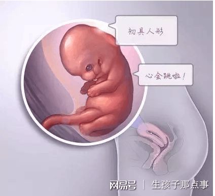 第三代试管婴儿
